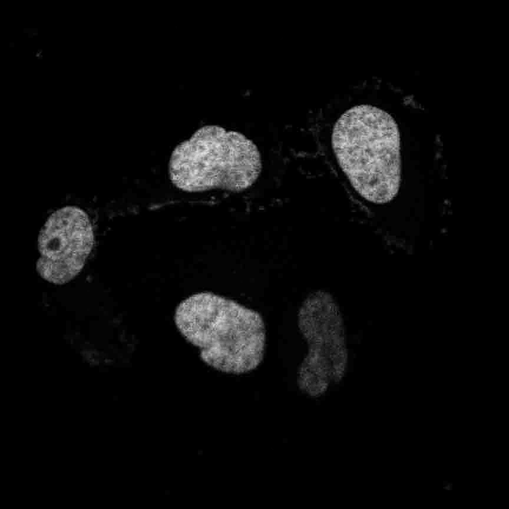 Armadillo repeat-containing X-linked protein 5 nucleus.jpg